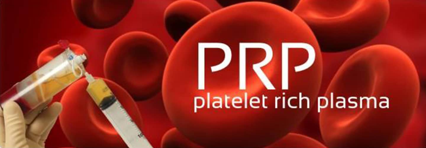 platelet rich plasma prp