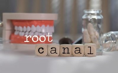 How to Tell If You Need a Root Canal: Signs and Symptoms