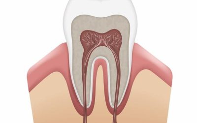 How to Choose an Endodontist: A Guide to Finding the Right Specialist