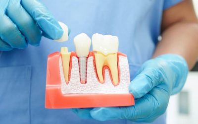 What Procedures Does an Endodontist Perform?