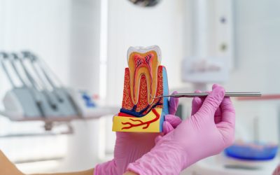 Debunking Root Canal Myths: Separating Fact from Fiction