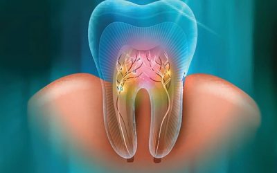 Choosing the Right Endodontist for Your Root Canal Treatment