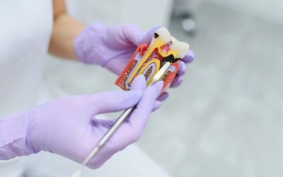 Understanding Endodontics: Your Guide to Kentucky Endodontics