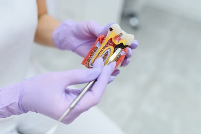 Understanding Endodontics: Your Guide to Kentucky Endodontics