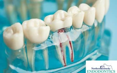 Understanding Endodontics: Your Guide to Root Canal Treatments