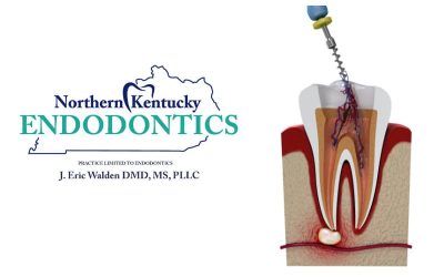 Expert Endodontic Care with KY Endodontics – Dr. Eric Walden DMD