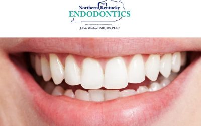 Preserve Your Natural Smile: Expert Endodontic Care at Kentucky Endodontics